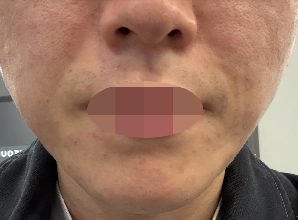 수술후기이미지