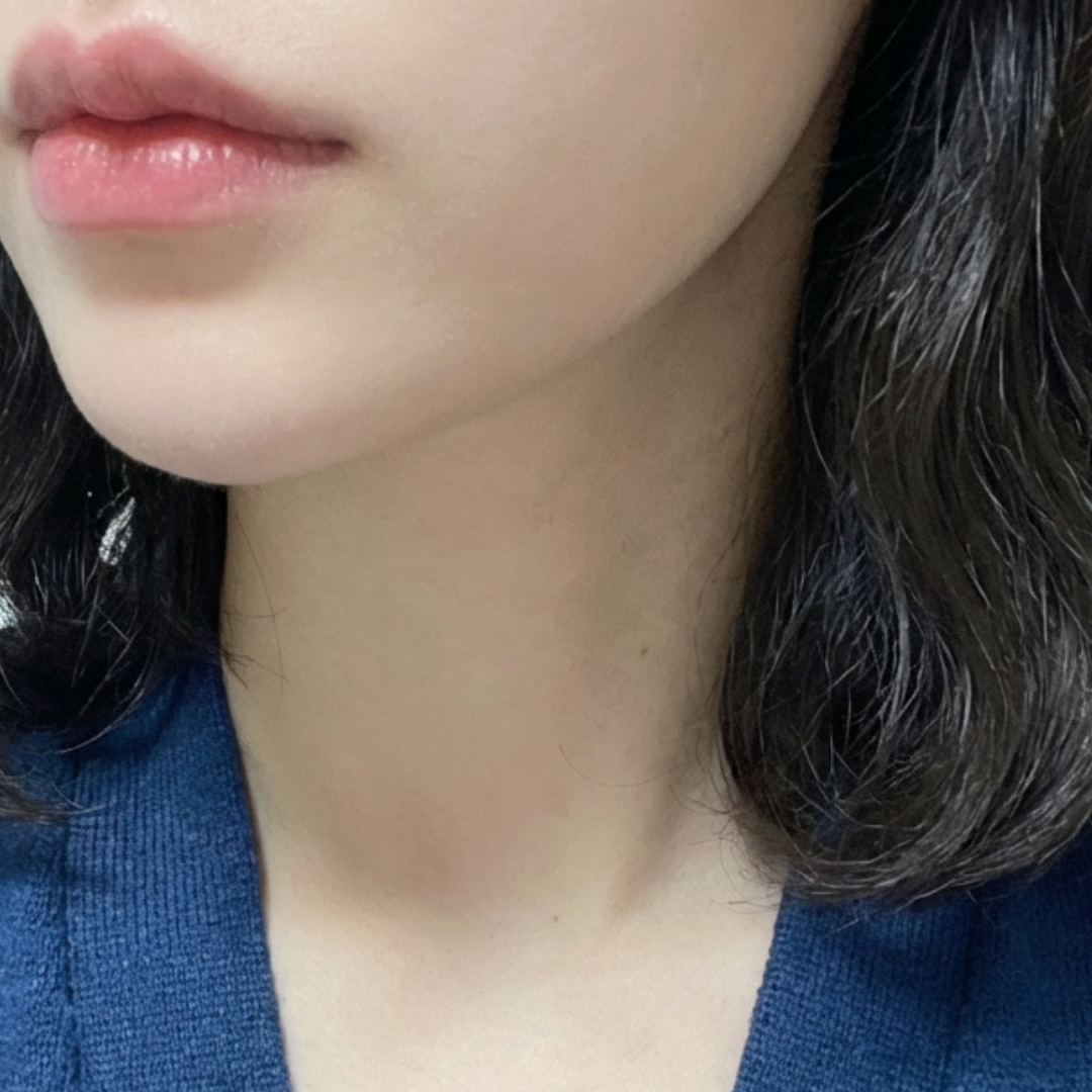 수술후기이미지