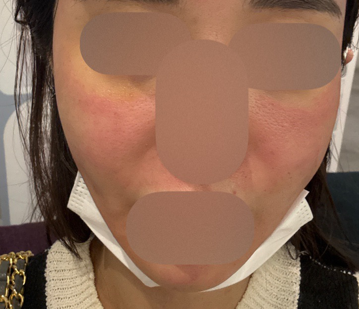 수술후기이미지