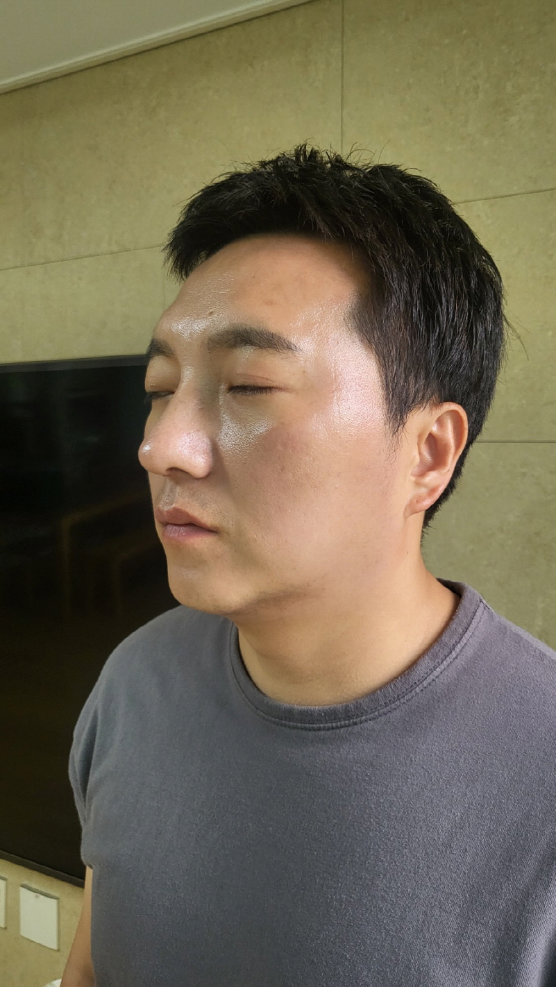 수술후기이미지