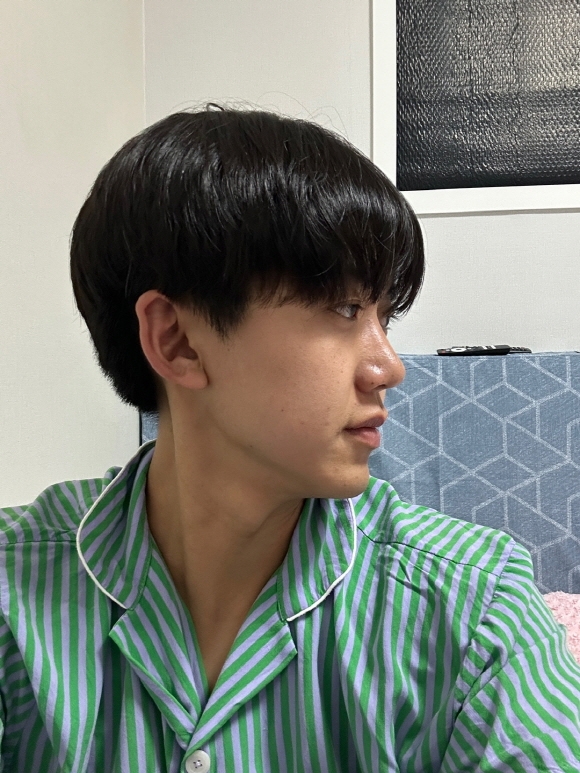 수술후기이미지