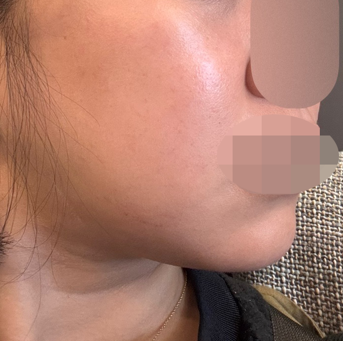 수술후기이미지