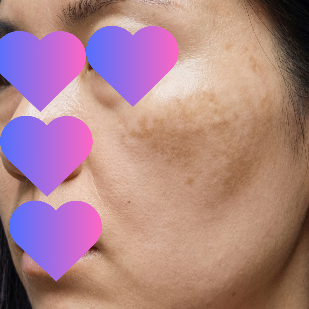 수술후기이미지