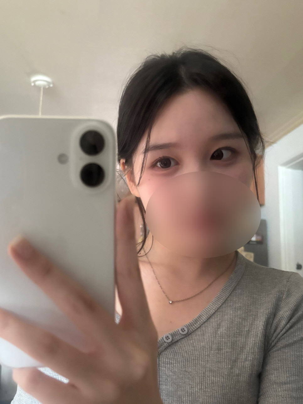 수술후기이미지