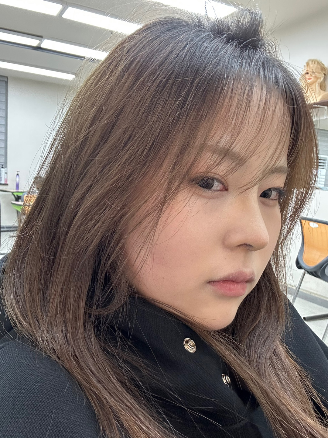 수술후기이미지