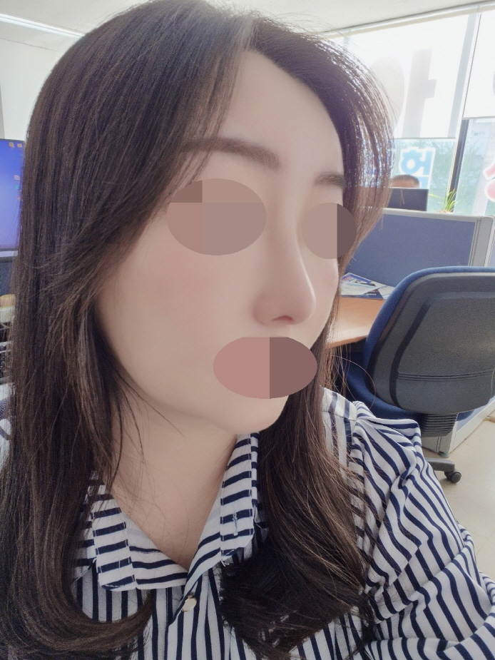 수술후기이미지