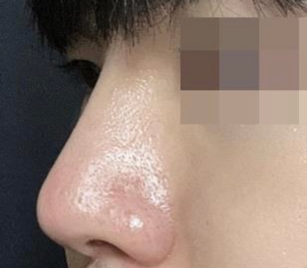 수술후기이미지