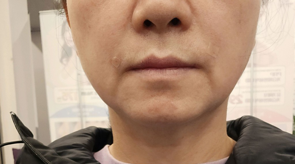 수술후기이미지