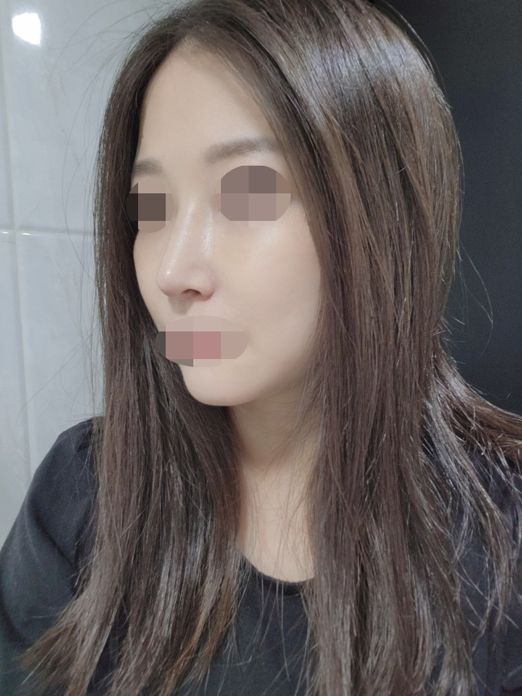 수술후기이미지