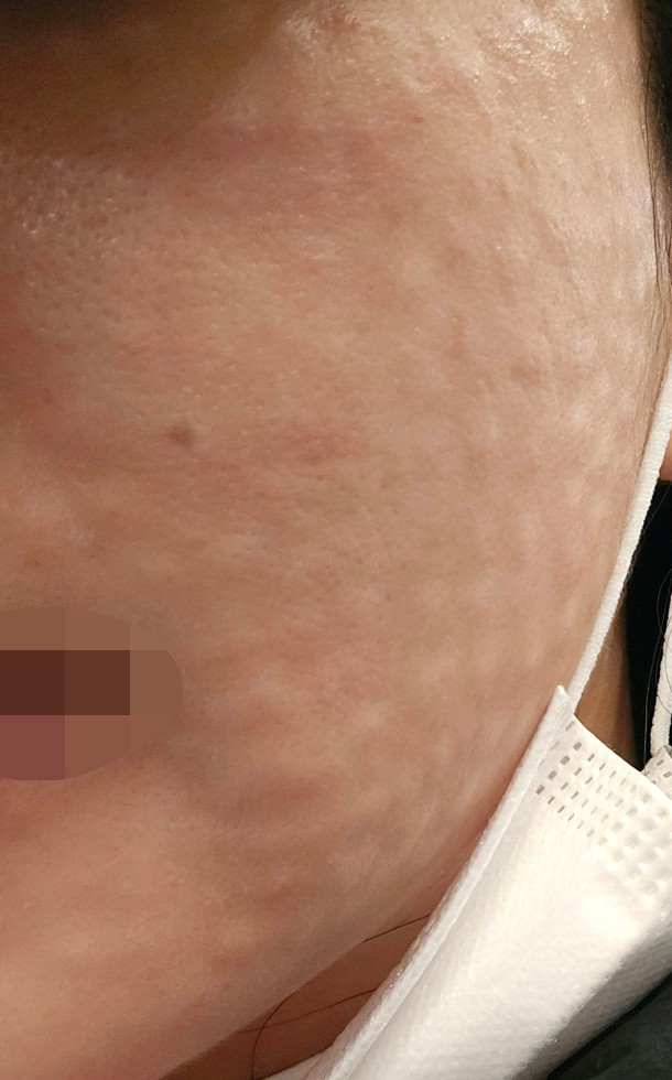 수술후기이미지