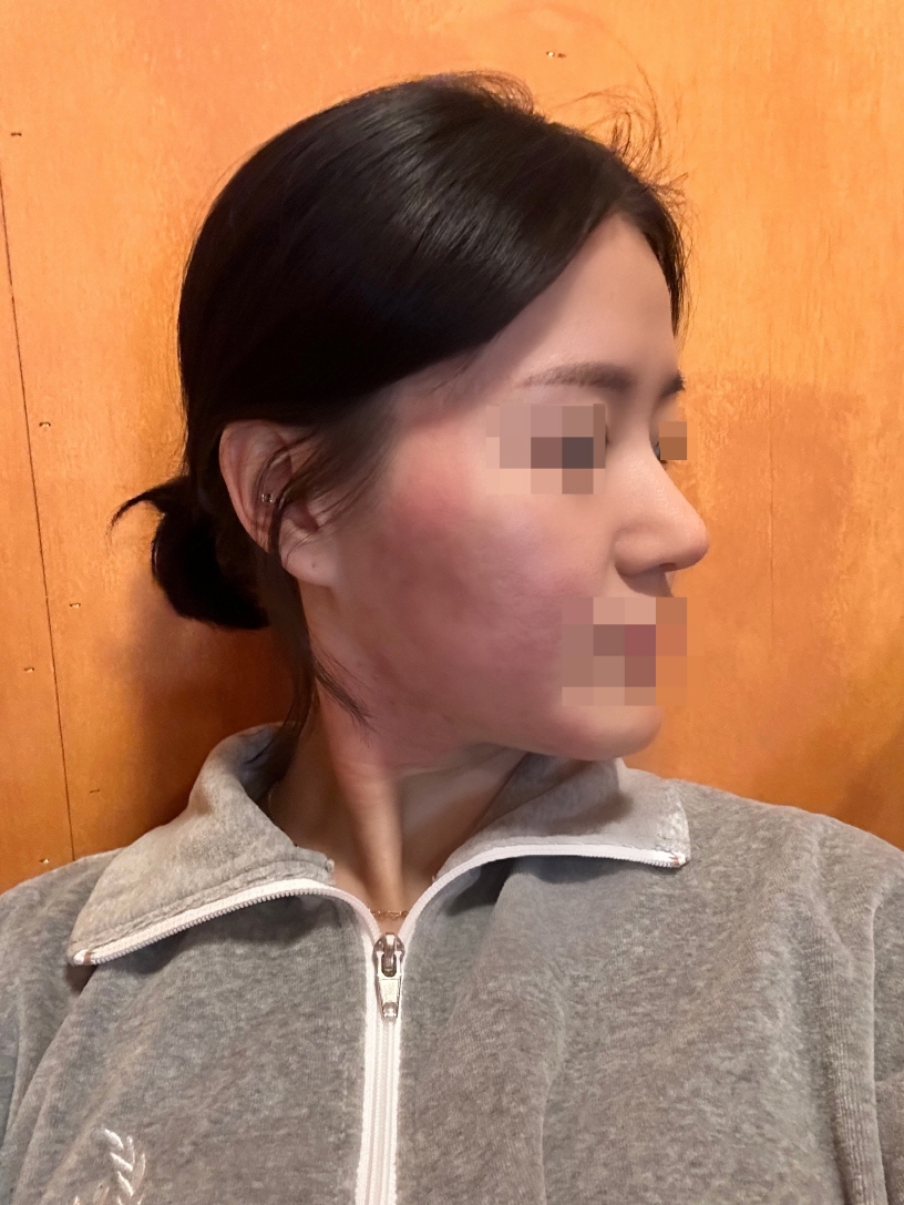 수술후기이미지