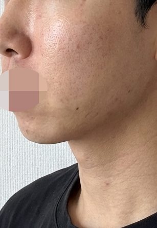 수술후기이미지