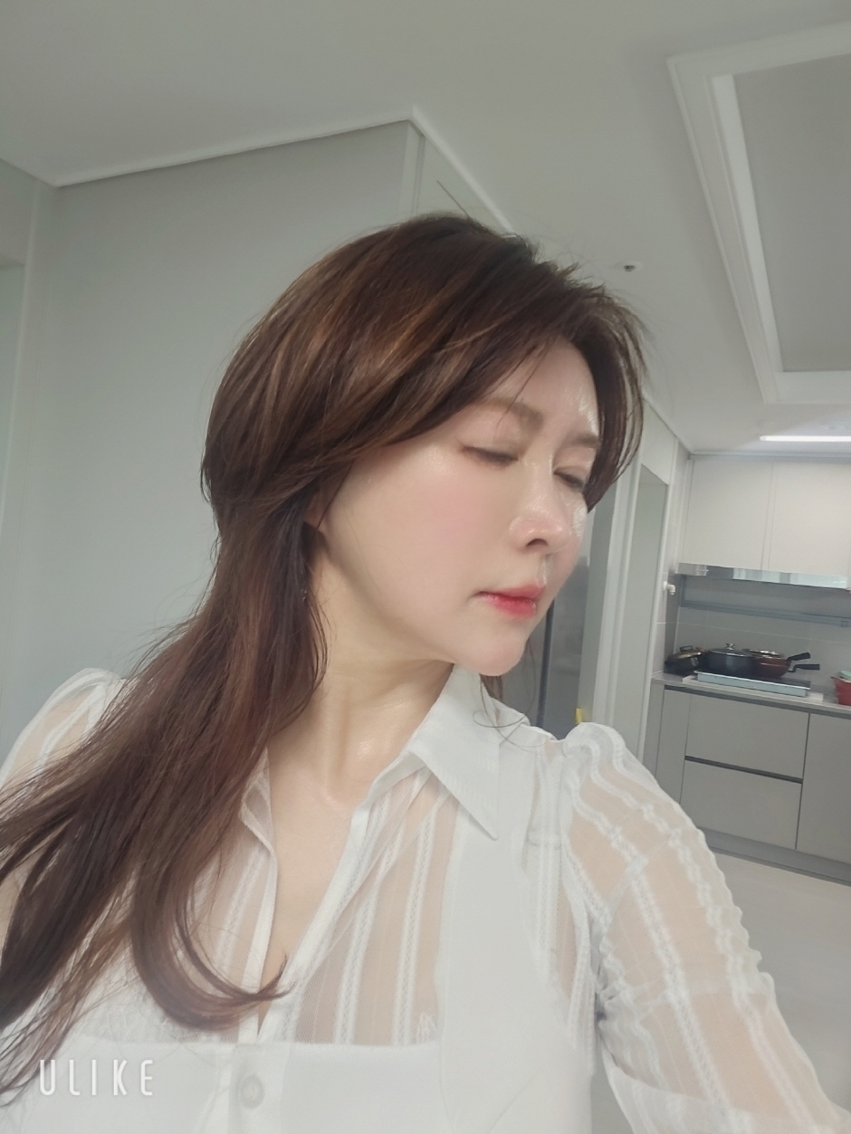 수술후기이미지