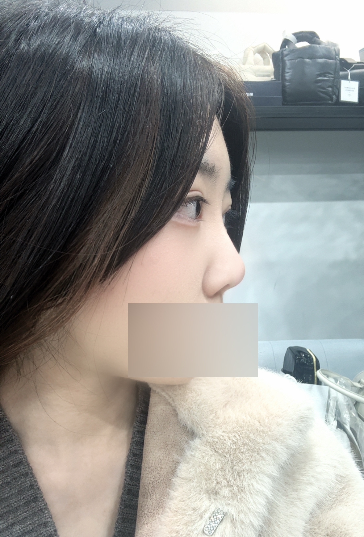 수술후기이미지