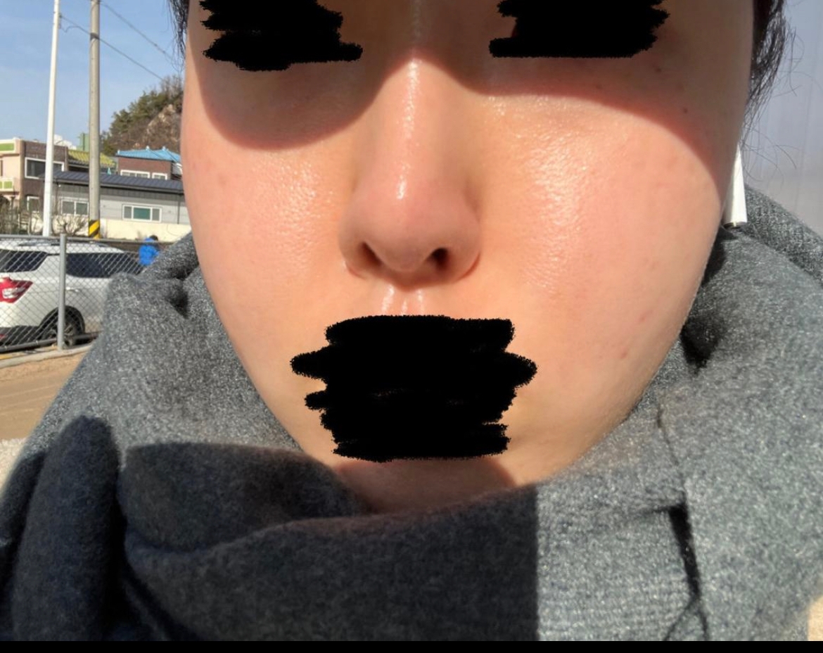 수술후기이미지