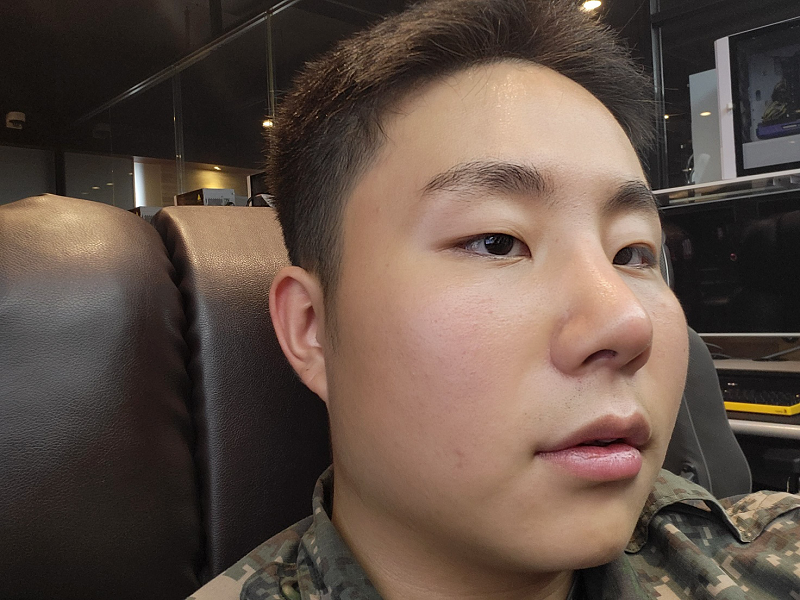 수술후기이미지