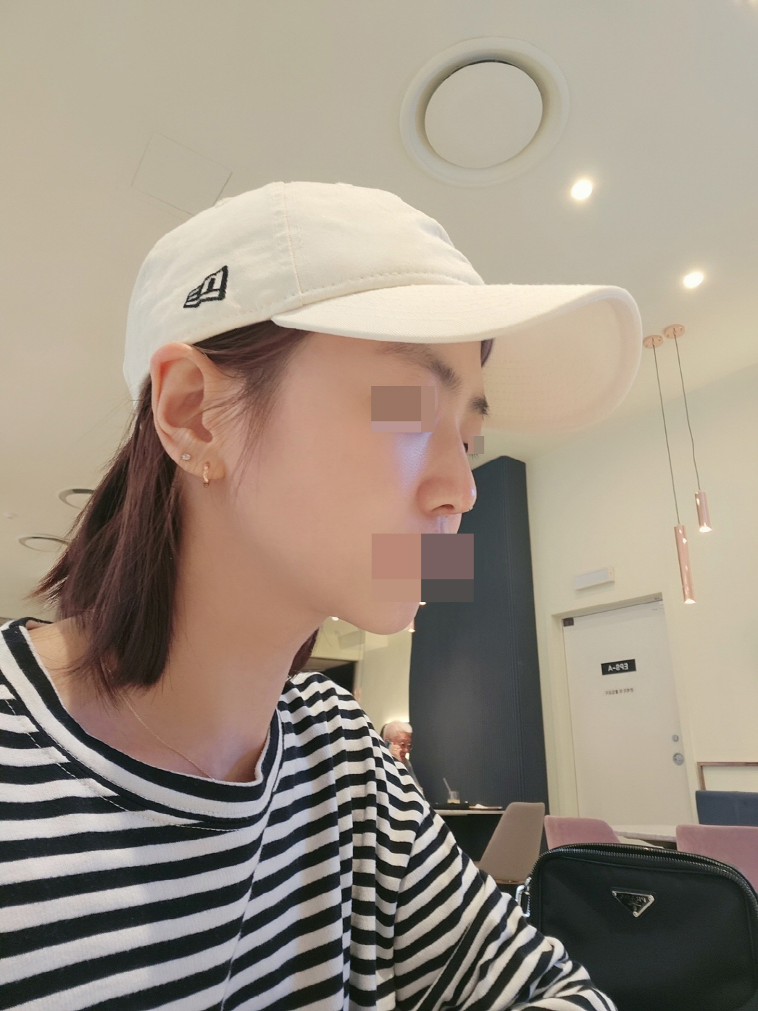 수술후기이미지