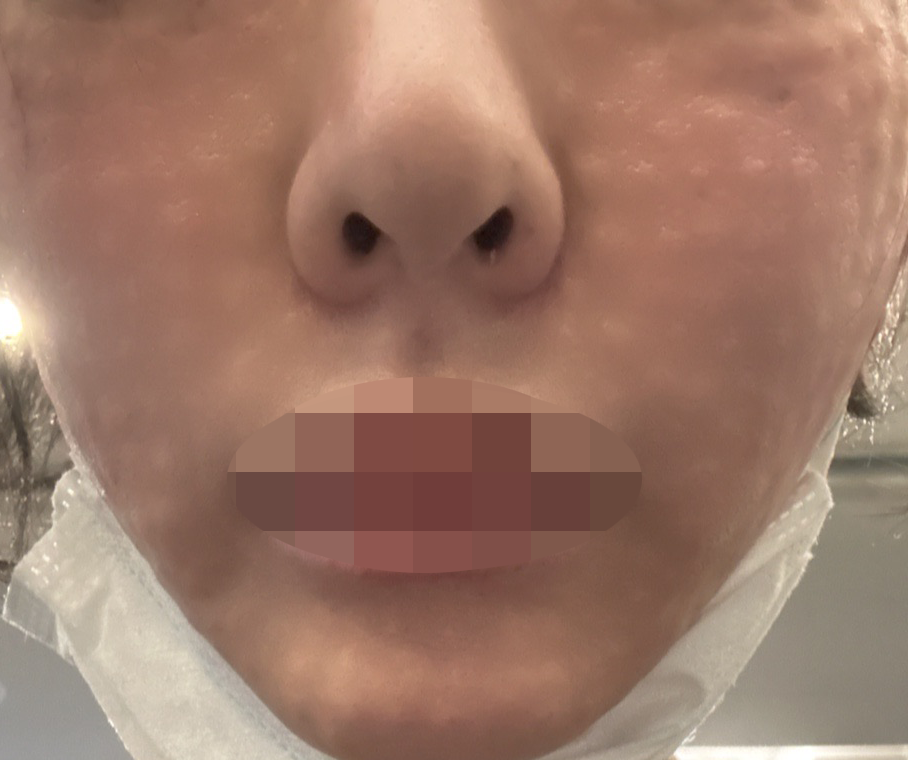 수술후기이미지