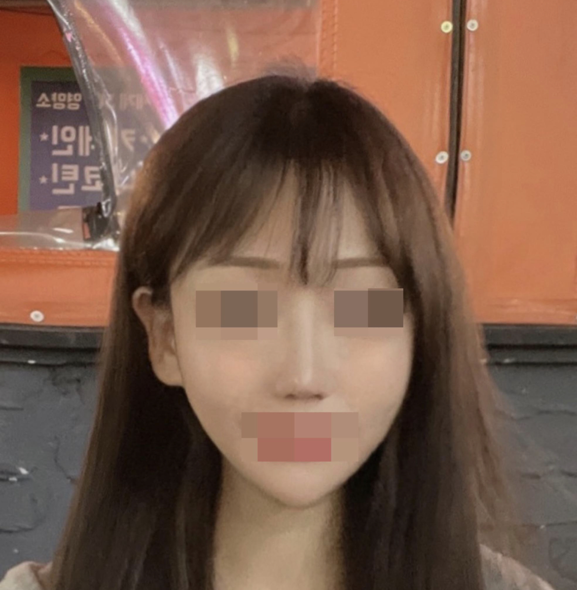 수술후기이미지