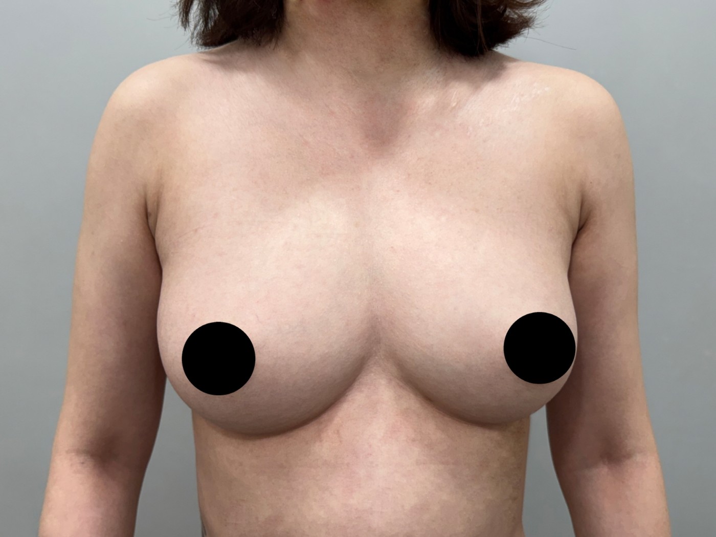 수술후기이미지