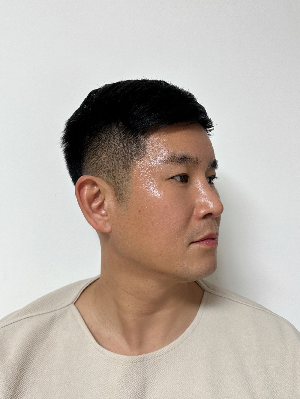 수술후기이미지