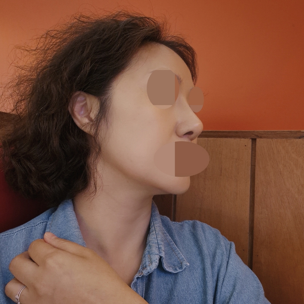 수술후기이미지