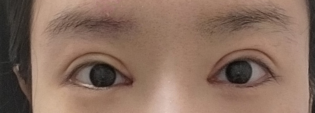 수술후기이미지