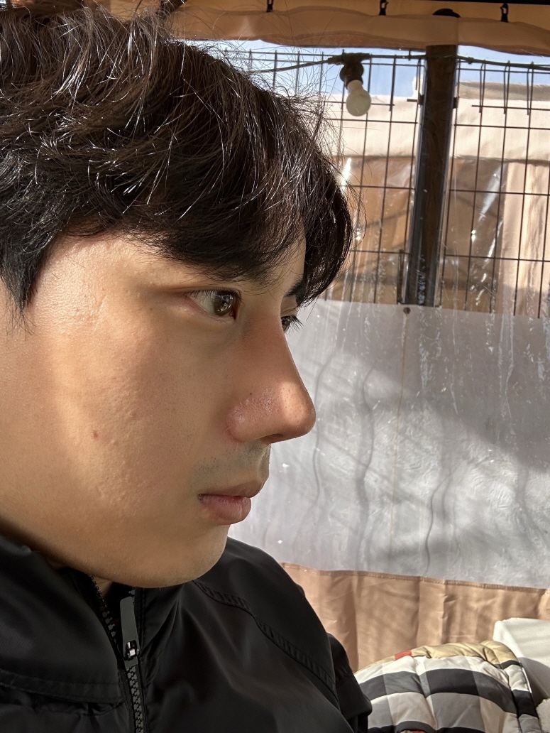 수술후기이미지