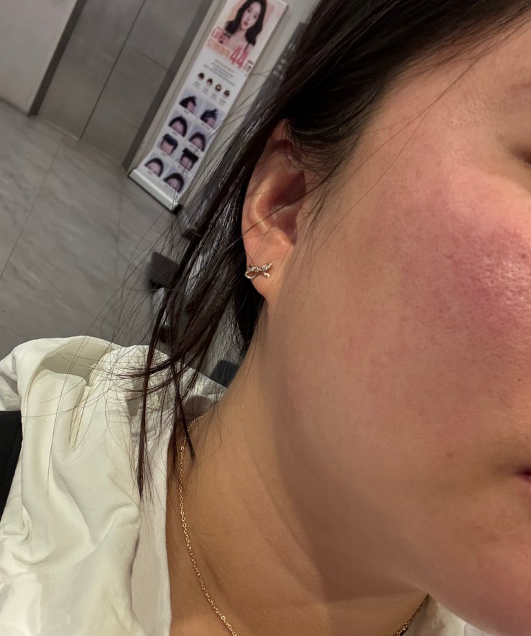 수술후기이미지