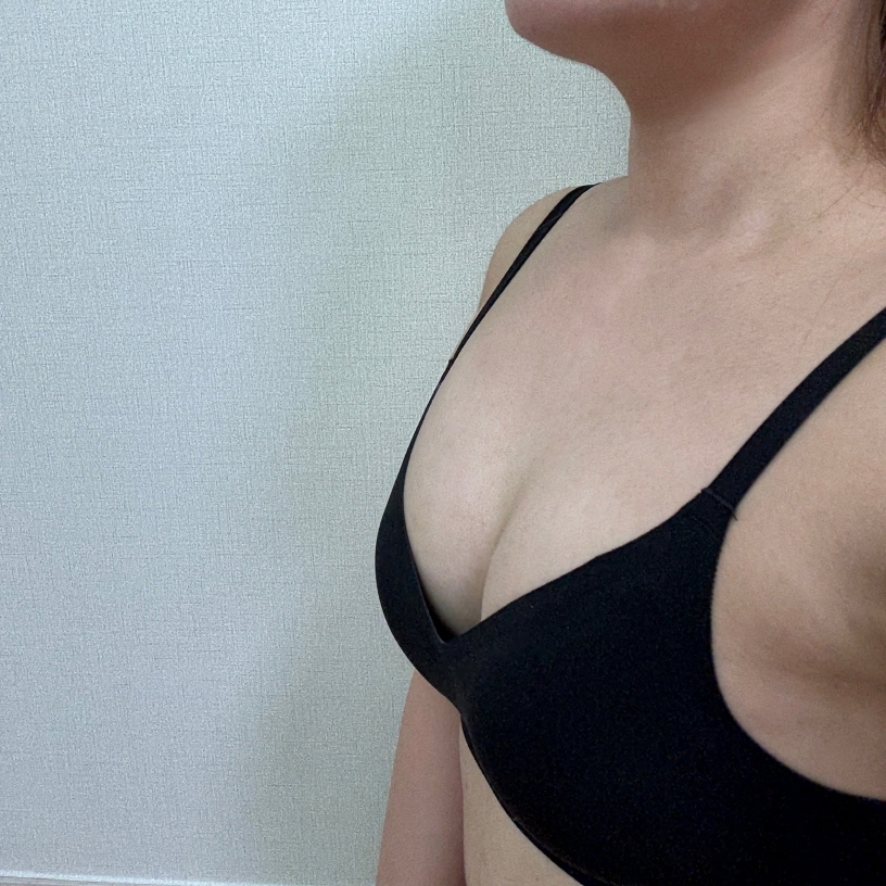 수술후기이미지