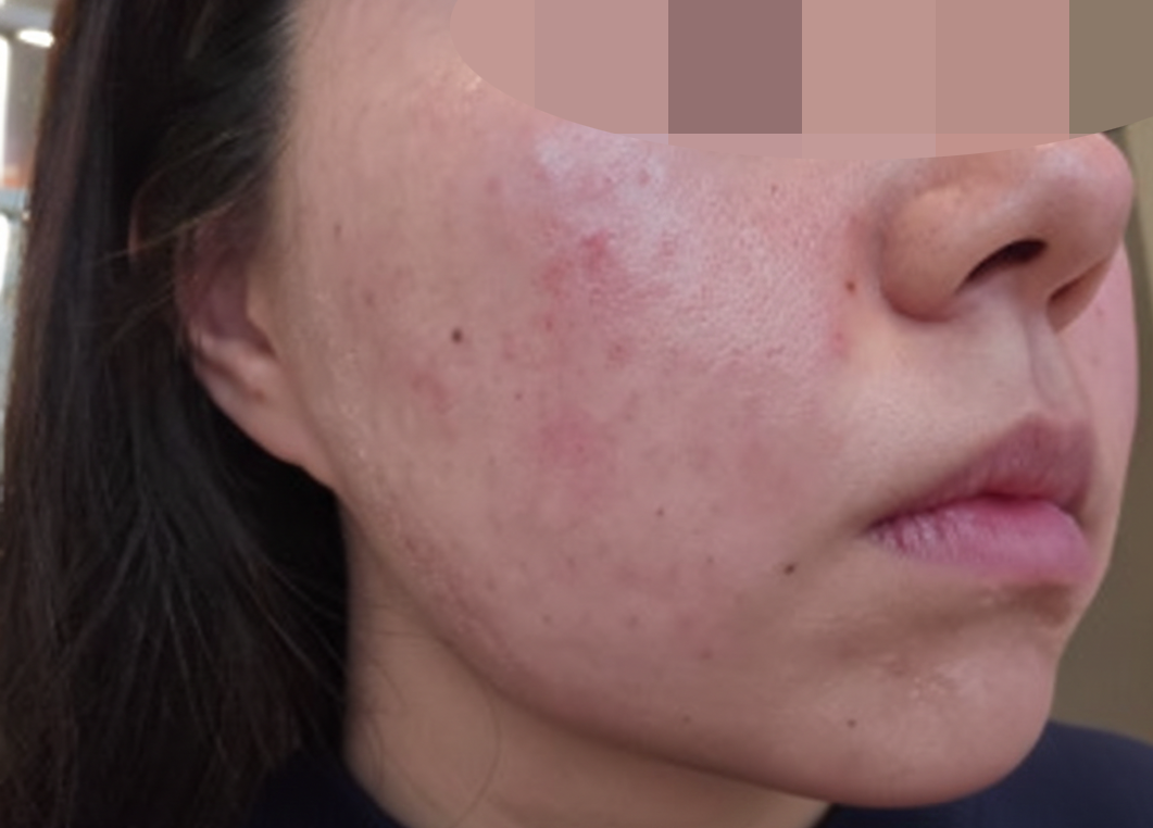 수술후기이미지