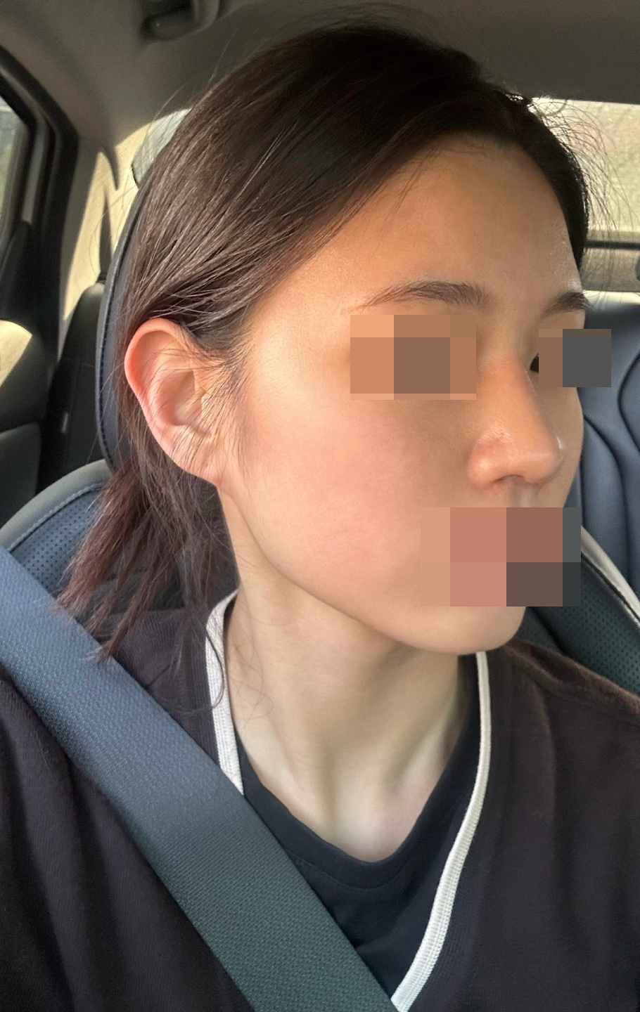 수술후기이미지