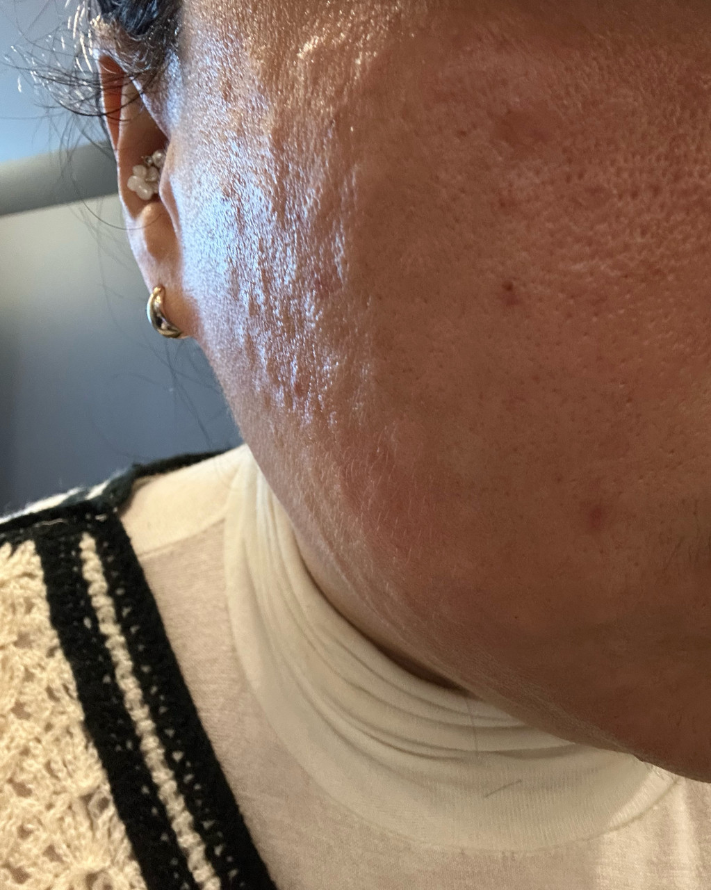 수술후기이미지