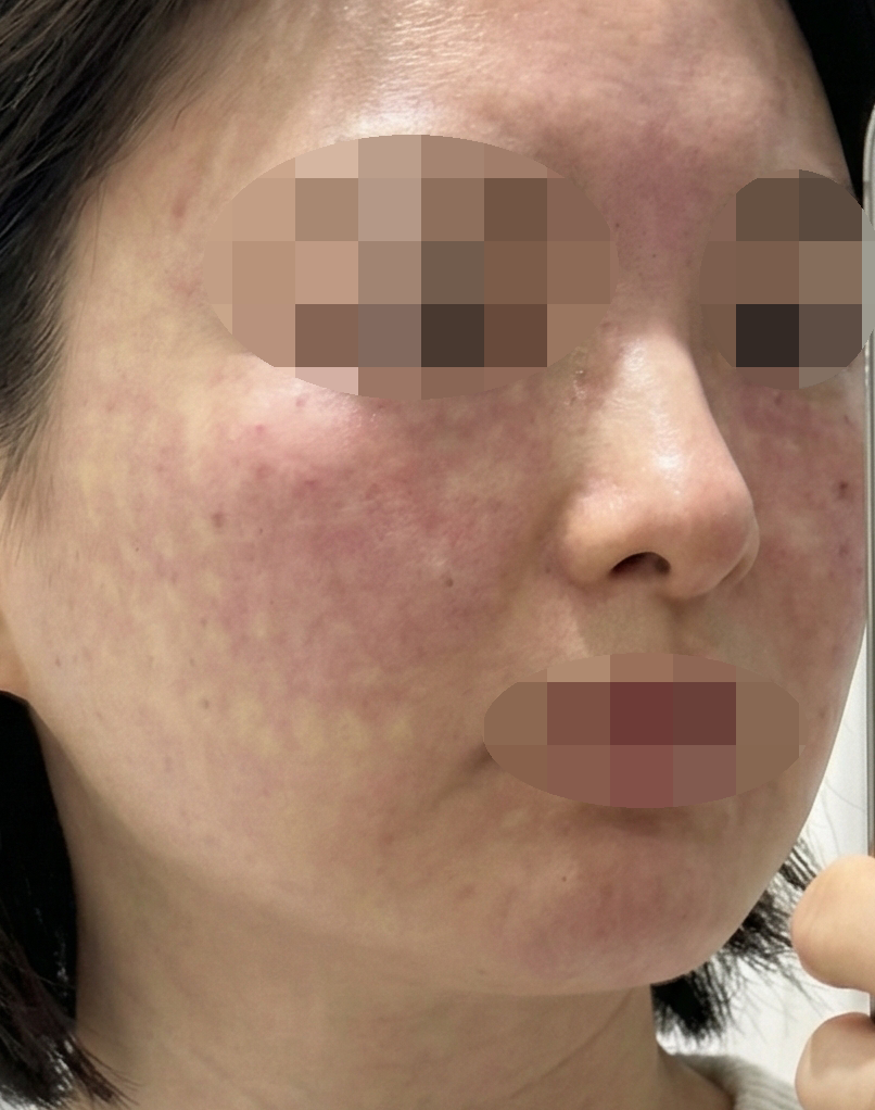 수술후기이미지