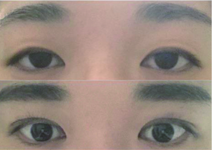 수술후기이미지