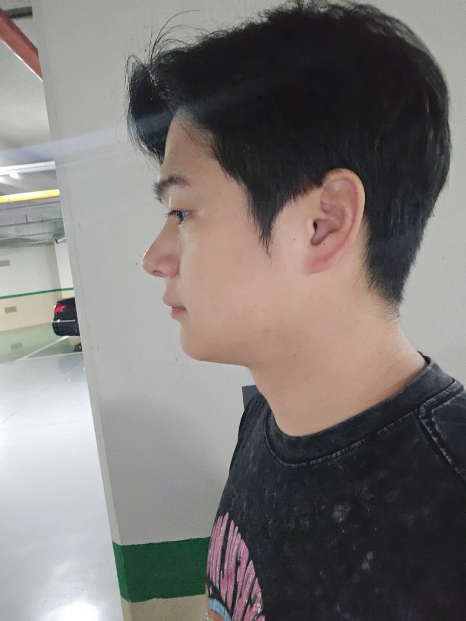 수술후기이미지