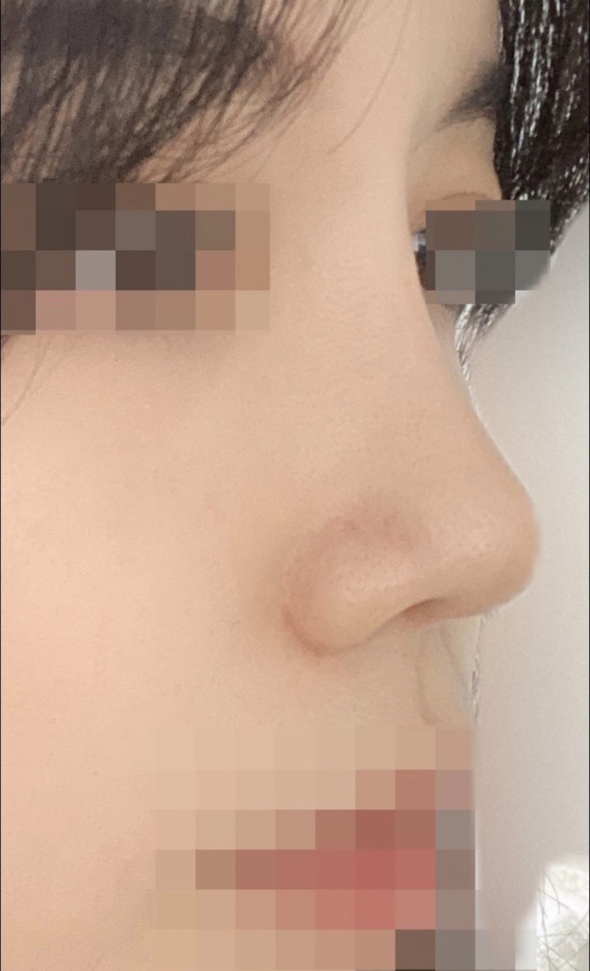 수술후기이미지