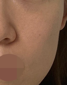 수술후기이미지