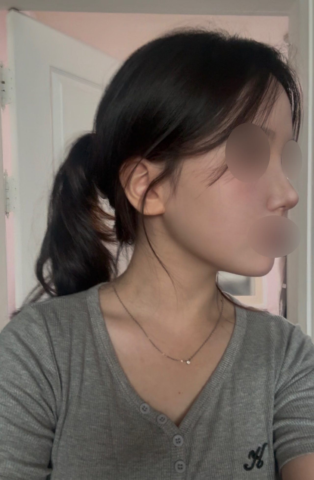 수술후기이미지