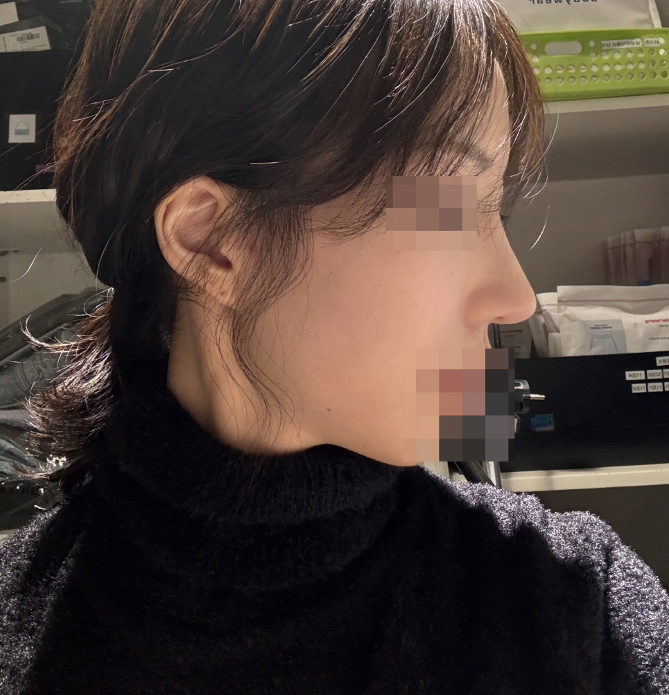 수술후기이미지