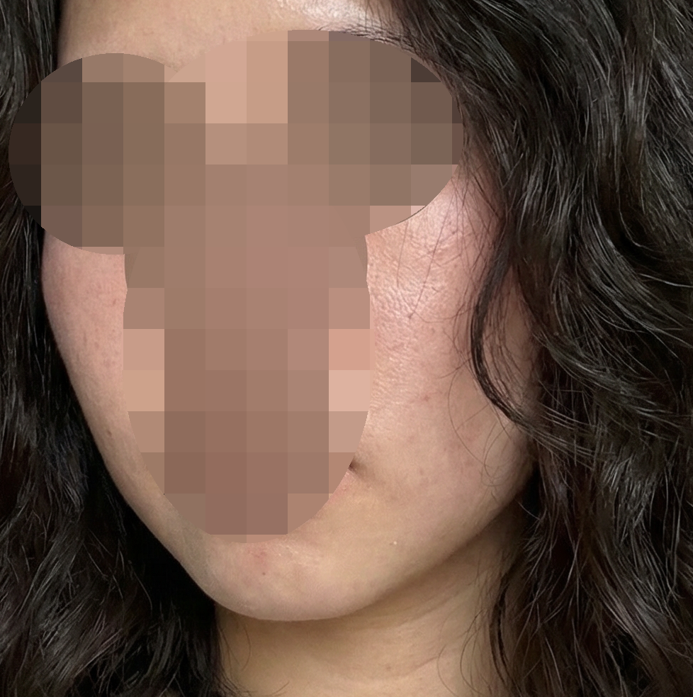 수술후기이미지