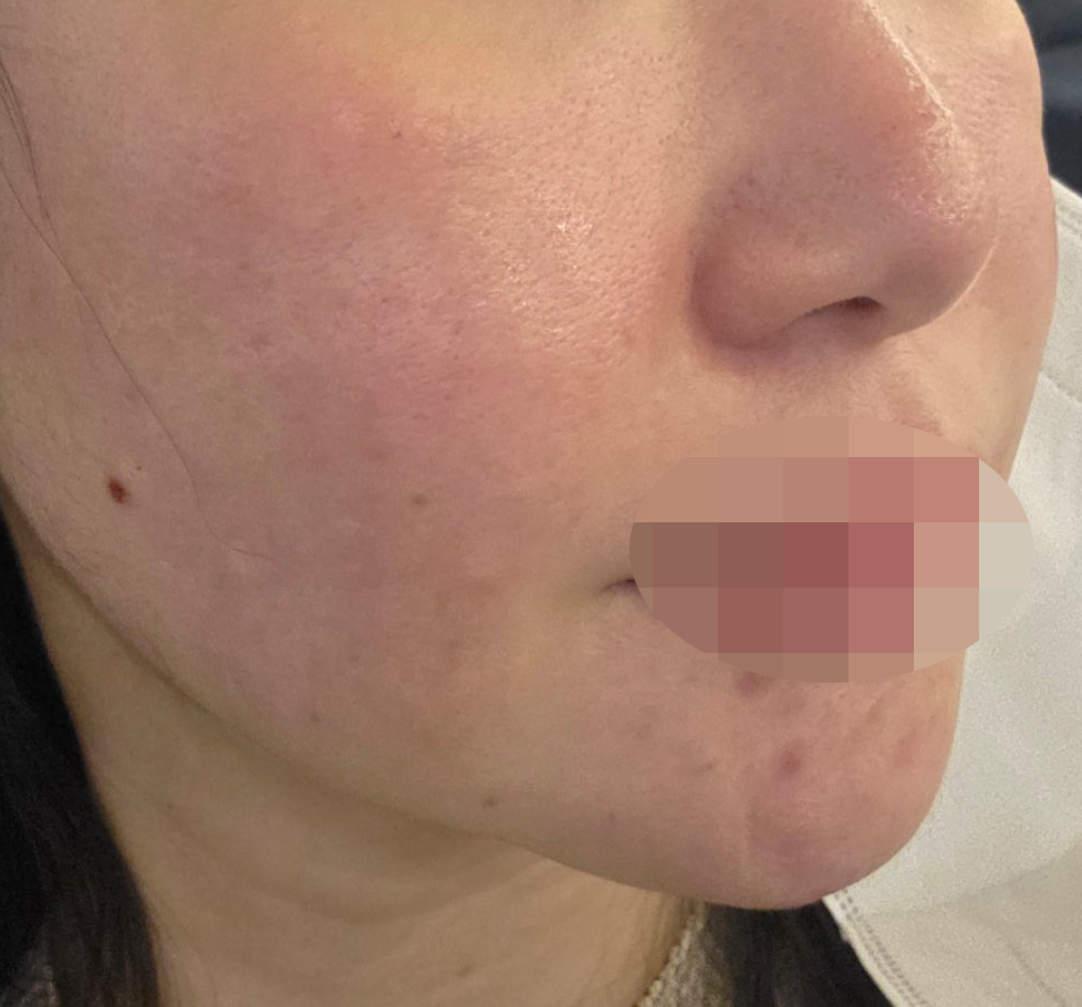 수술후기이미지