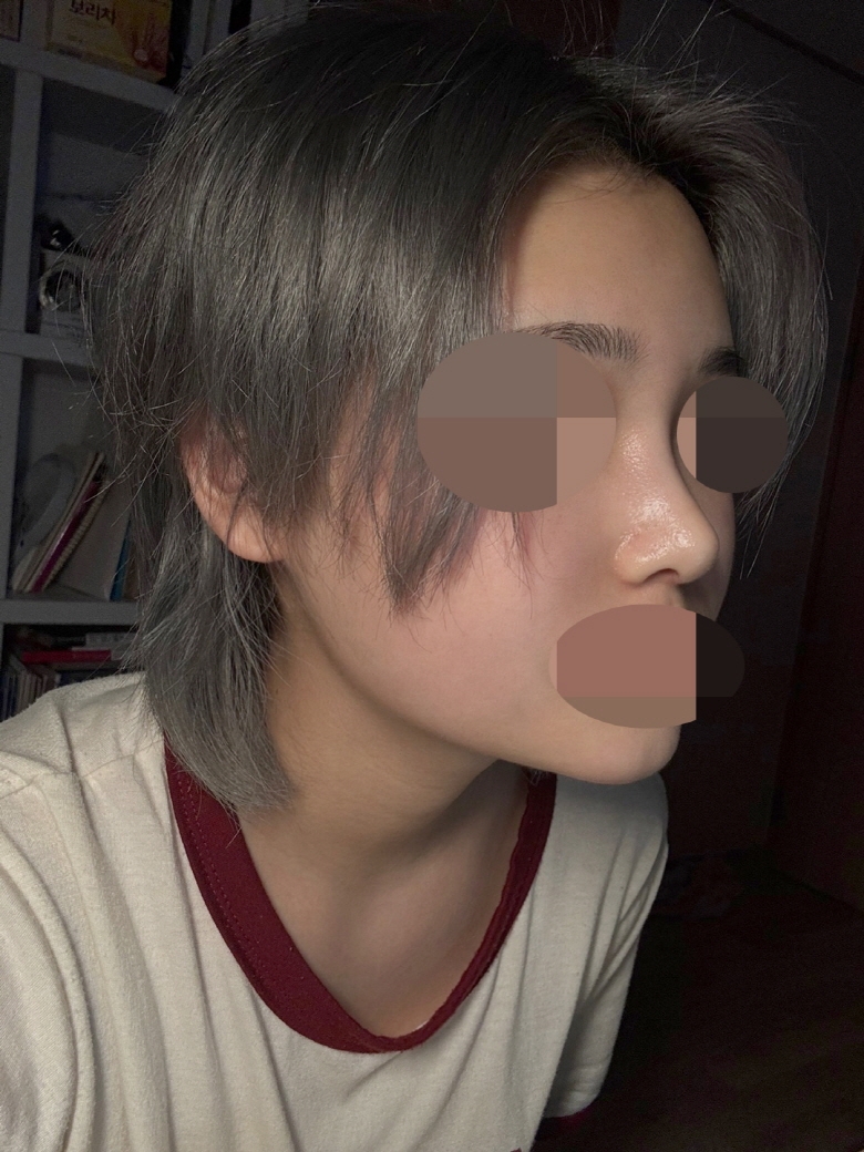 수술후기이미지