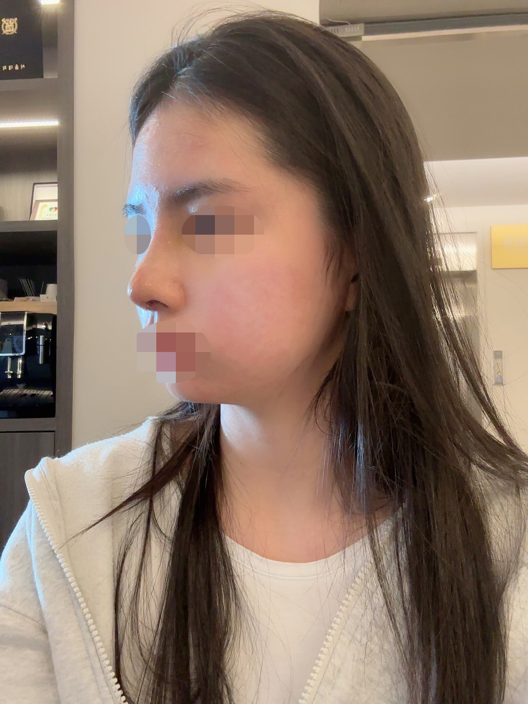 수술후기이미지