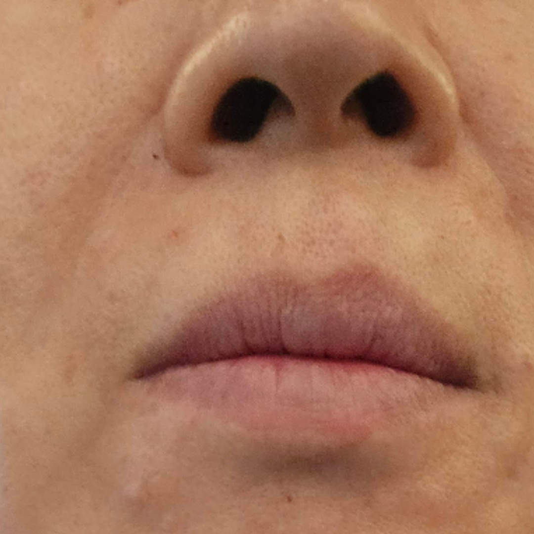 수술후기이미지