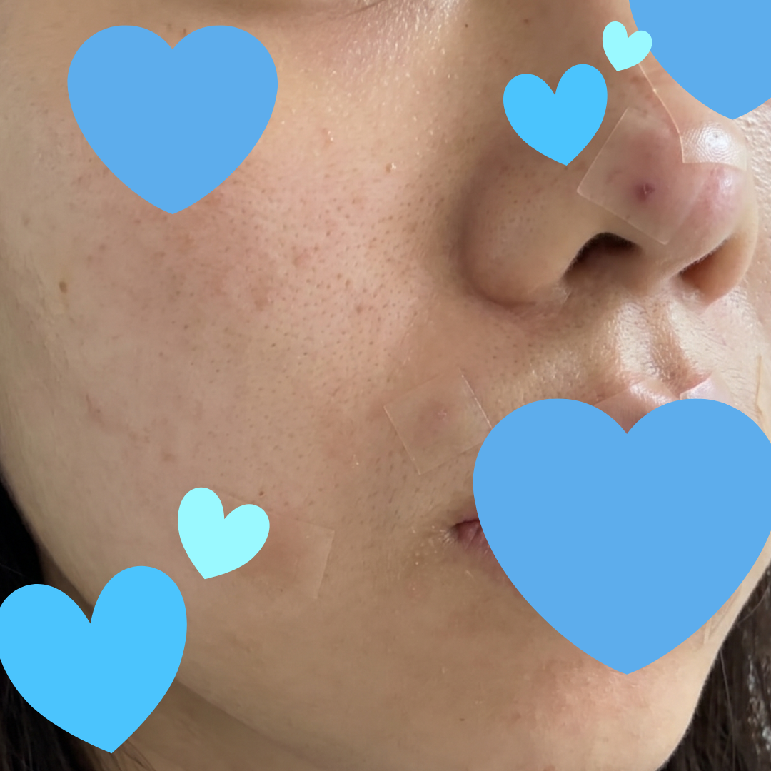 수술후기이미지