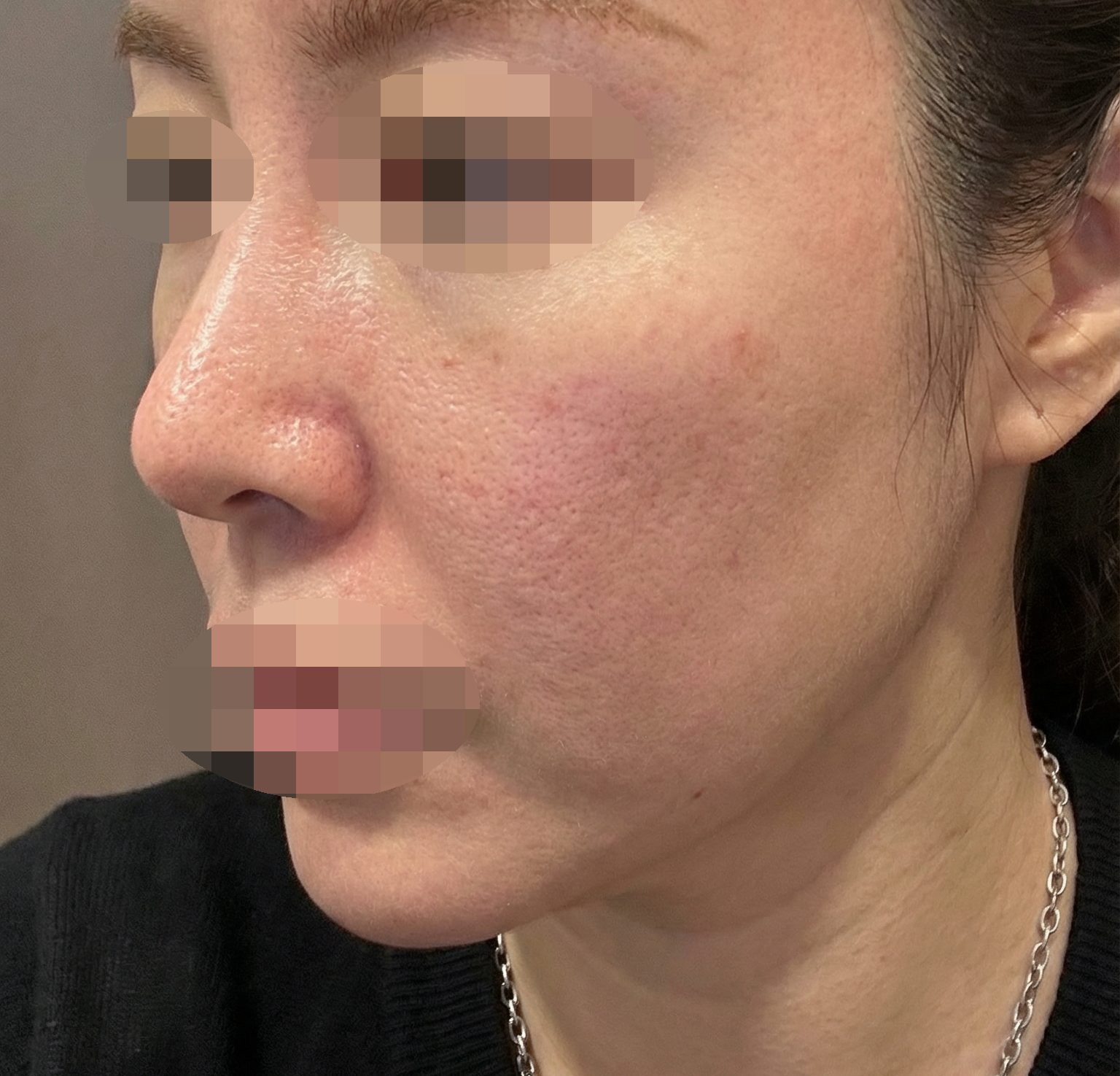 수술후기이미지