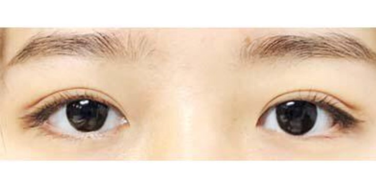 수술후기이미지