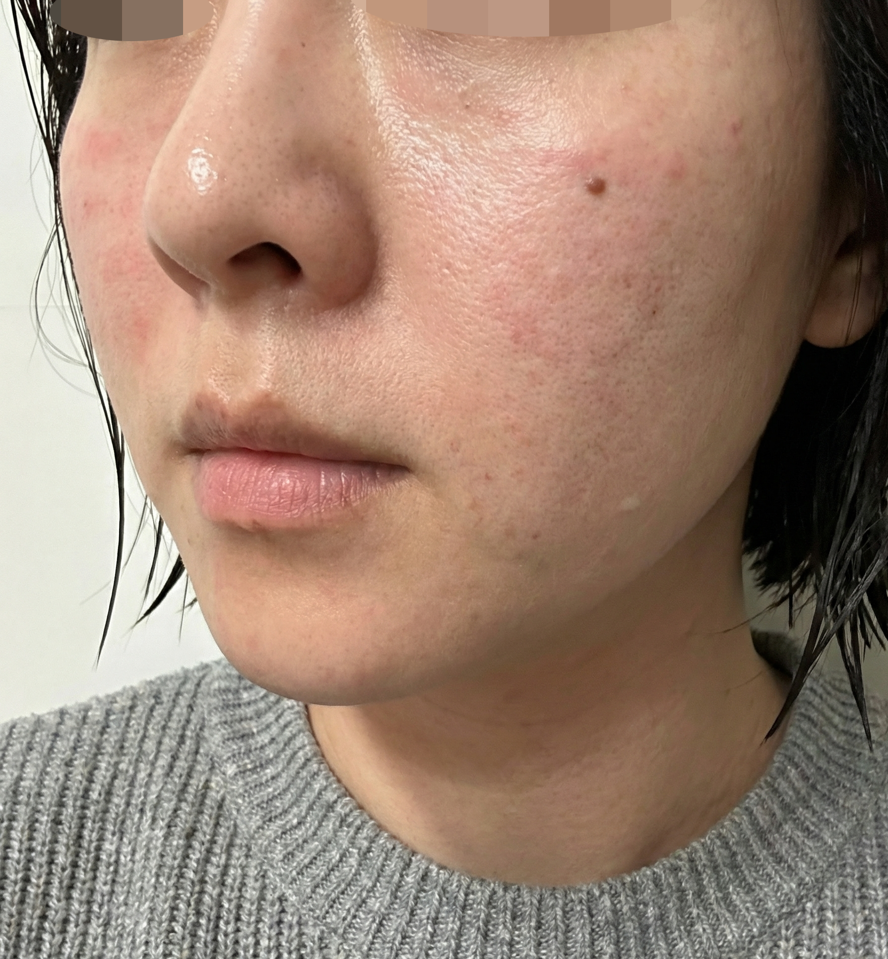 수술후기이미지