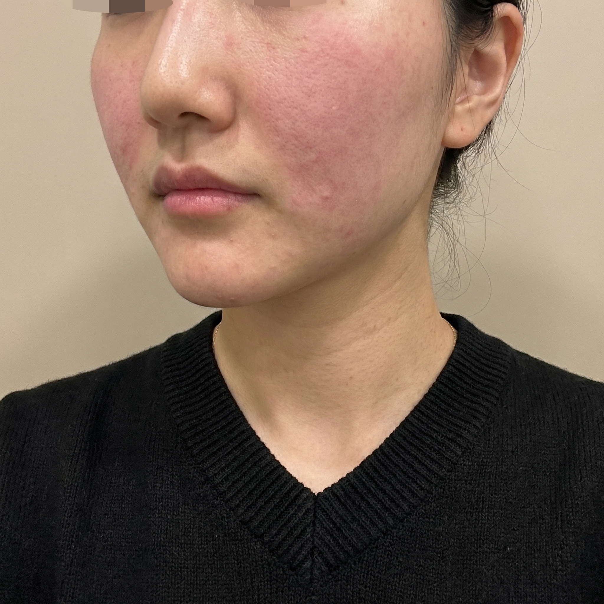 수술후기이미지